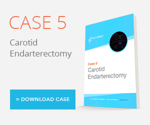Case Study: Carotid Endarterectomy