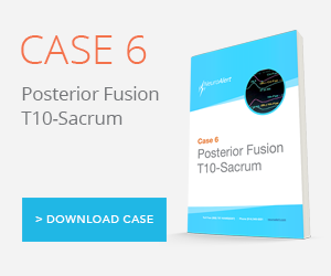 Case Study: Posterior Fusion T10-Sacrum